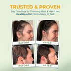 Vitalyra Biotin & B-Complex Hair Vitamins - Hair, Skin & Nails Supplement